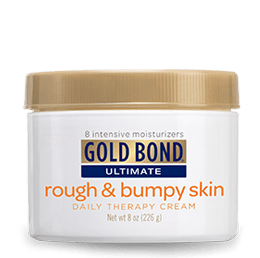 Keratosis Pilaris: Gold Bond Cream