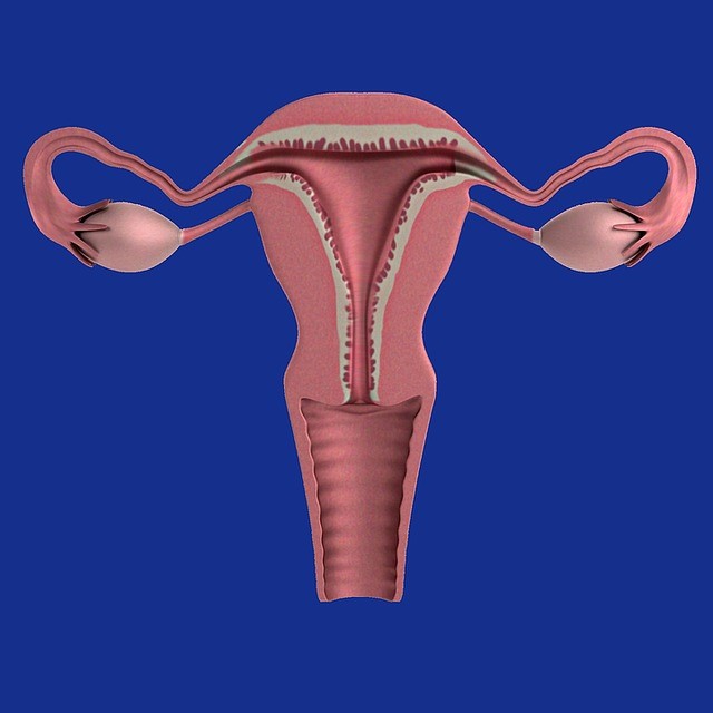 Ovarian Cancer: Female Reproductive System 