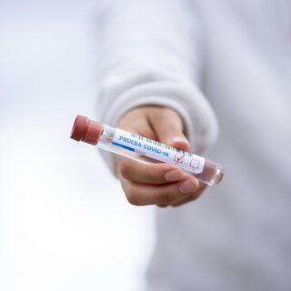 Level of Antibodies: Man holding test tube