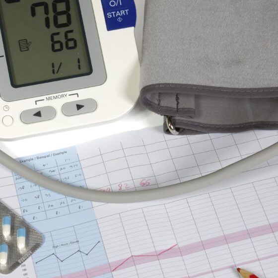 Hypertension Notifications: Digital Blood Pressure machine and note pad