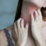 Ringworm and eczema: Itchy throat. Woman suffering from allergy, bacterial disease, common cold or drugs side effects symptoms.