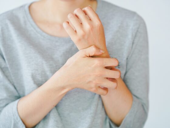 Zax's Original: A woman scratching her arm, experiencing an allergic reaction or being stung by an insect. Skin disease concept.