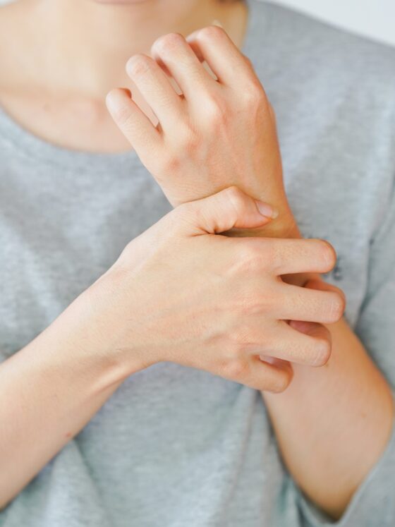 Zax's Original: A woman scratching her arm, experiencing an allergic reaction or being stung by an insect. Skin disease concept.