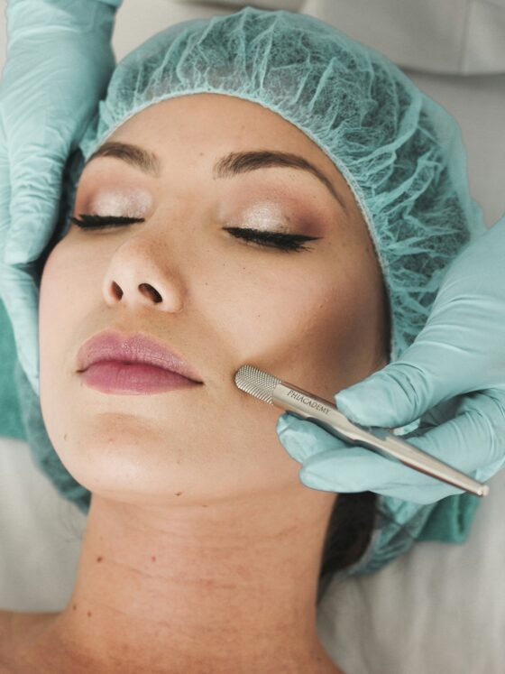 Facial Rejuvenation: Woman lying down with surgical cap on as someone is doing a procedure.